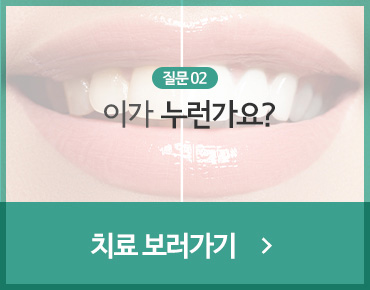 이가 누런가요?