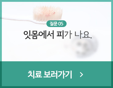 잇몸에서 피가 나요